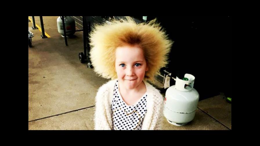 La historia de la niña con un síndrome que hace que sea imposible peinarla 