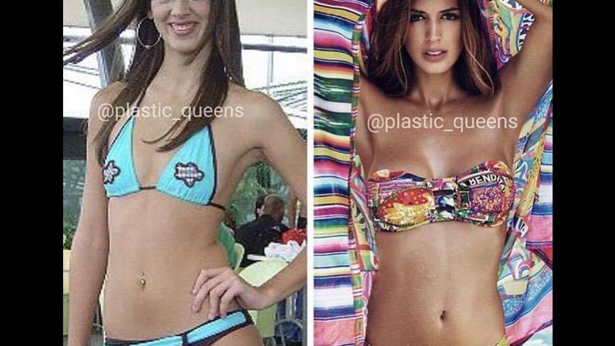 Lo que hacen las cirugías, mire aquí a Shannon de Lima, la novia de Canelo, antes y después