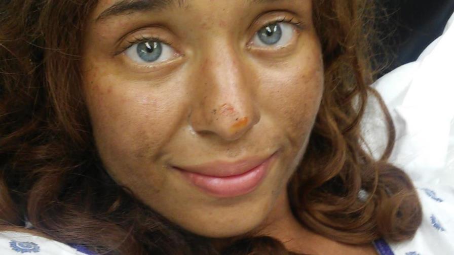 Mujer sobrevive un mes en el bosque