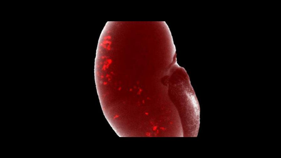 Cada año se diagnostican 21,000 nuevos casos de cáncer de riñón en América Latina