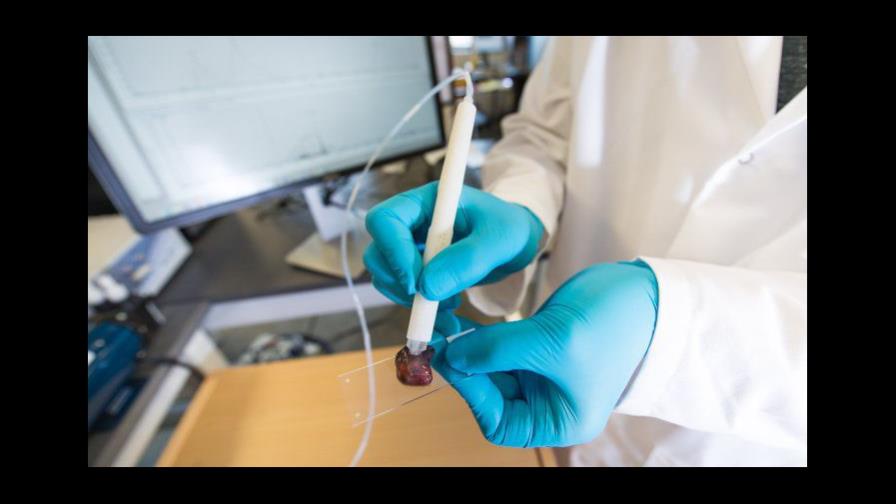 Crean aparato para identificar el cáncer