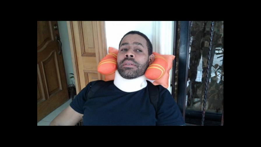 Reportero gráfico denuncia está perdiendo movilidad de sus brazos por falta de una operación 