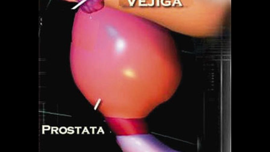 Combinación de medicamentos para tratar la próstata