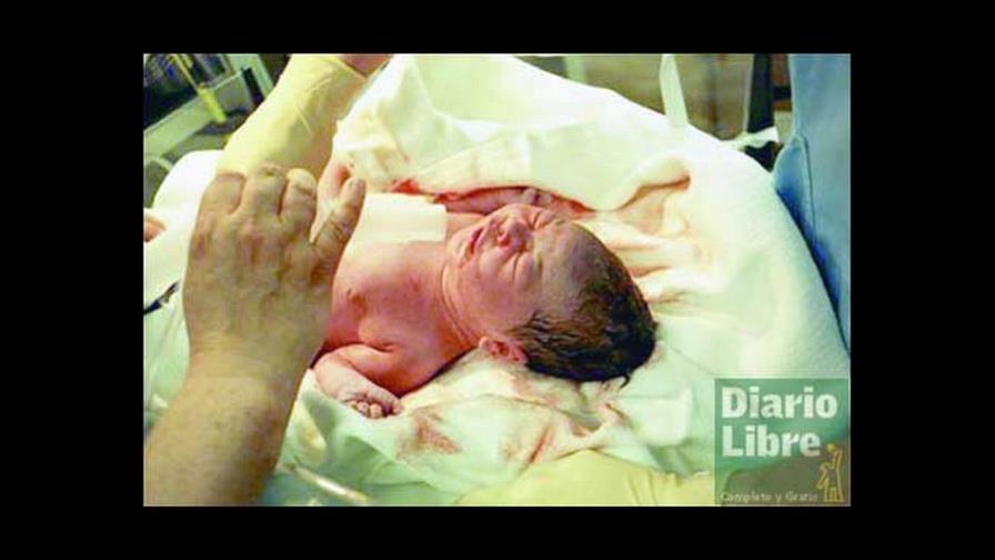 Retrasar parto en bebés prematuros puede evitar daños cerebrales