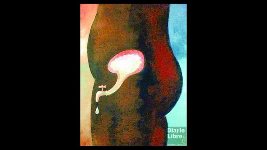 Corrigen sin cirugía la incontinencia urinaria