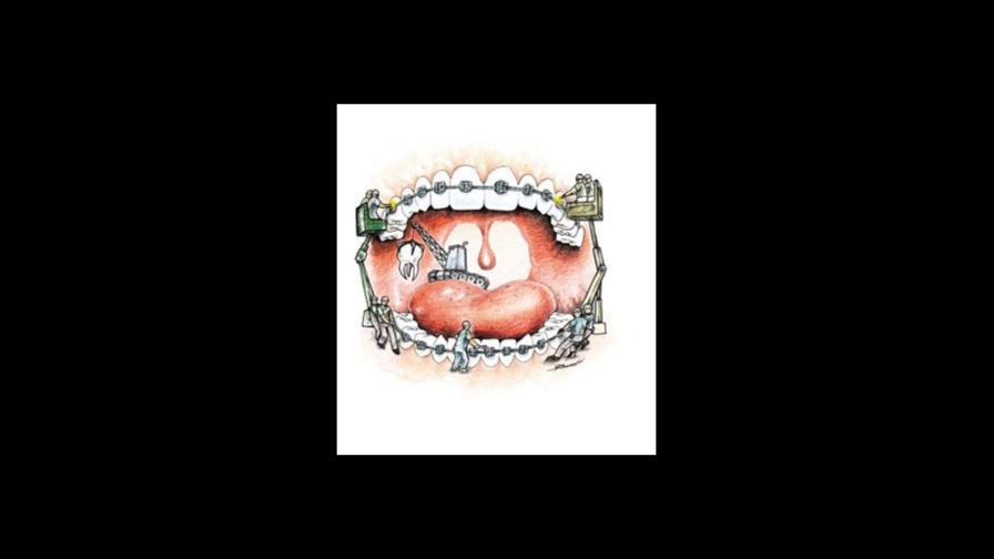 brackets: ¿Moda o necesidad?