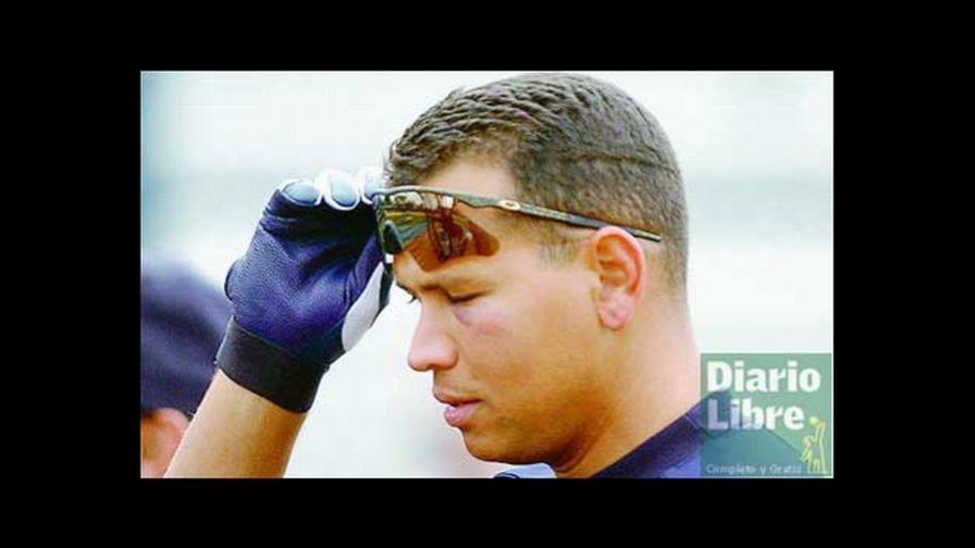 Alex Rodríguez no tiene problemas por golpe de pelota en la mejilla