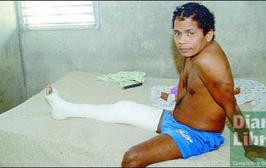 Los lisiados de San Francisco de Macorís