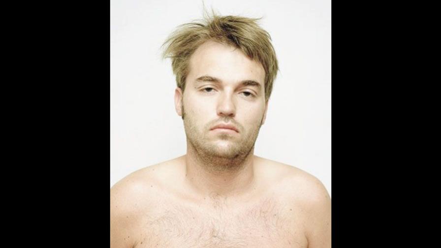 ¿Cómo puedo saber si tengo síndrome de fatiga crónica?