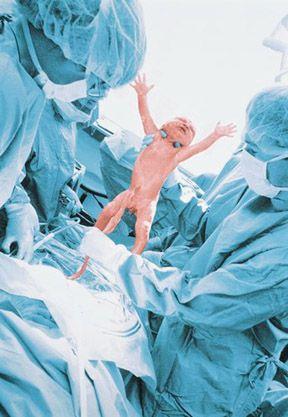 El exceso de ácido fólico aumenta el riesgo de cáncer de mama