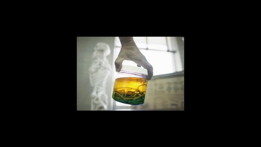 Científicos buscan en gusanos esperanza para curar el asma