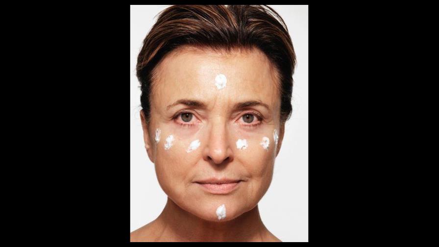 ¿Líneas de expresión o líneas de la edad?