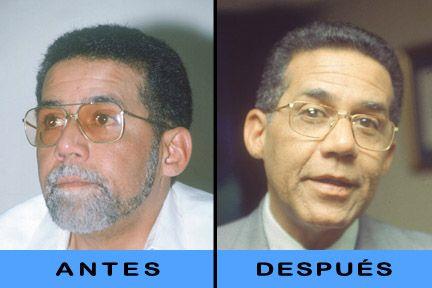 Un pelo del bigote: la mejor garantía