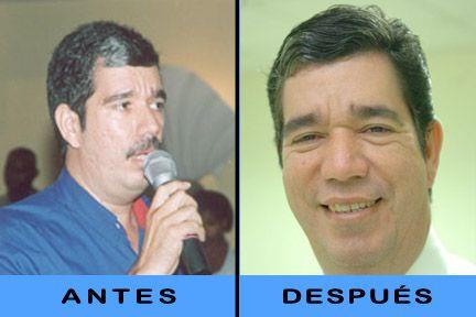 Un pelo del bigote: la mejor garantía