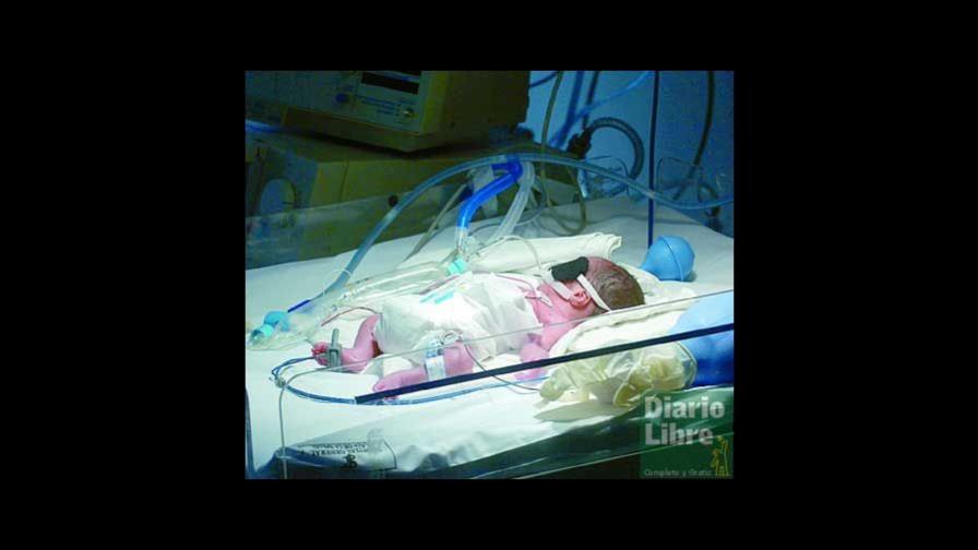 Los sextillizos en estado crítico; el padre pide ayuda al Gobierno