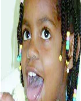 Reconstruyen esófago con parte del intestino grueso Reconstruyen esófago con parte del intestino grueso