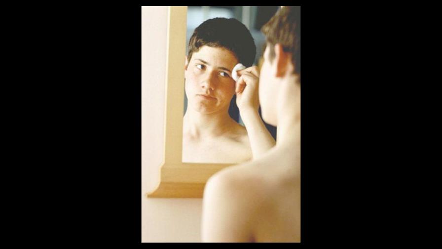 Combatiendo el acné Combatiendo el acné