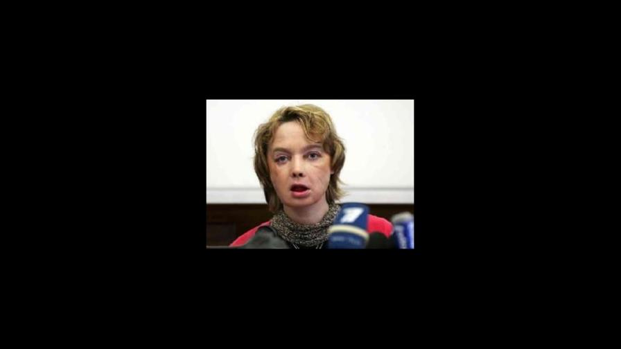 Mujer recibió trasplante de cara está agradecida