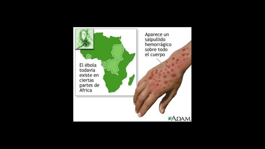 Al menos 116 muertos en rebrote de ébola en la provincia congoleña de Kasai