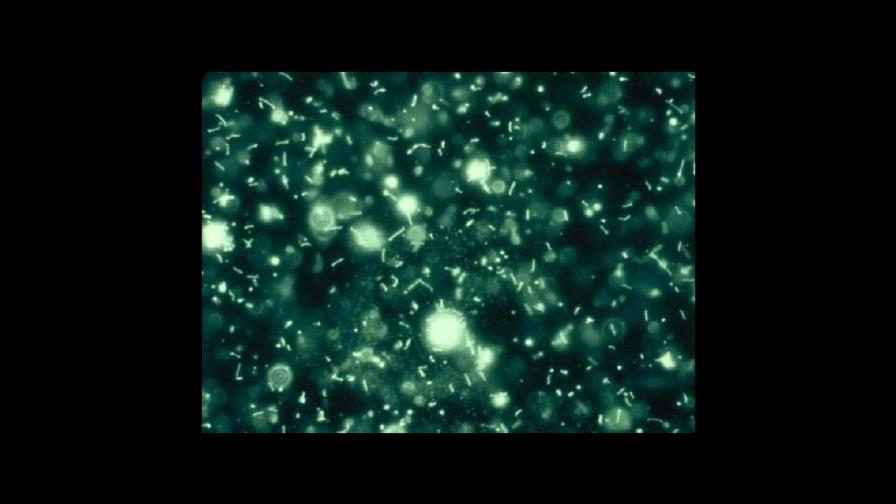 SESPAS dice hay 25 muertos y 193 casos de leptospirosis SESPAS dice hay 25 muertos y 193 casos de leptospirosis