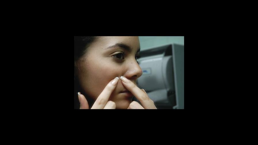 Un enemigo: El acné