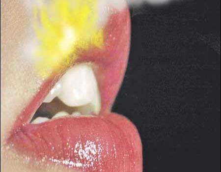 Los Herpes: una tendencia en el verano