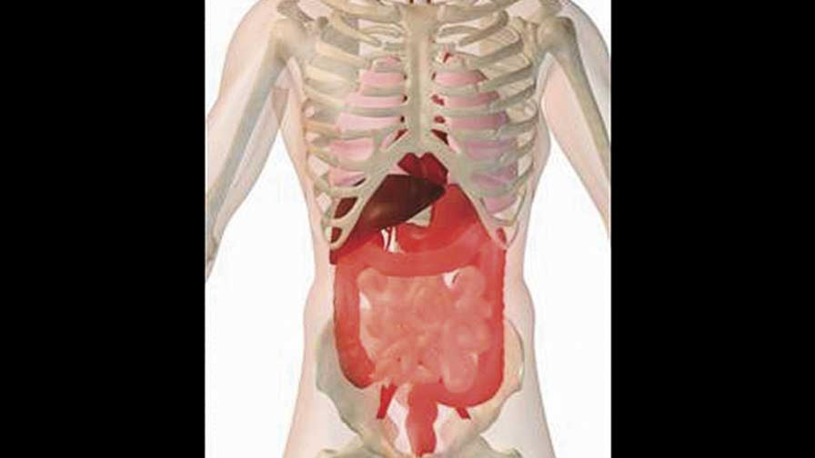 Síndrome de intestinos: productor de enfermedades