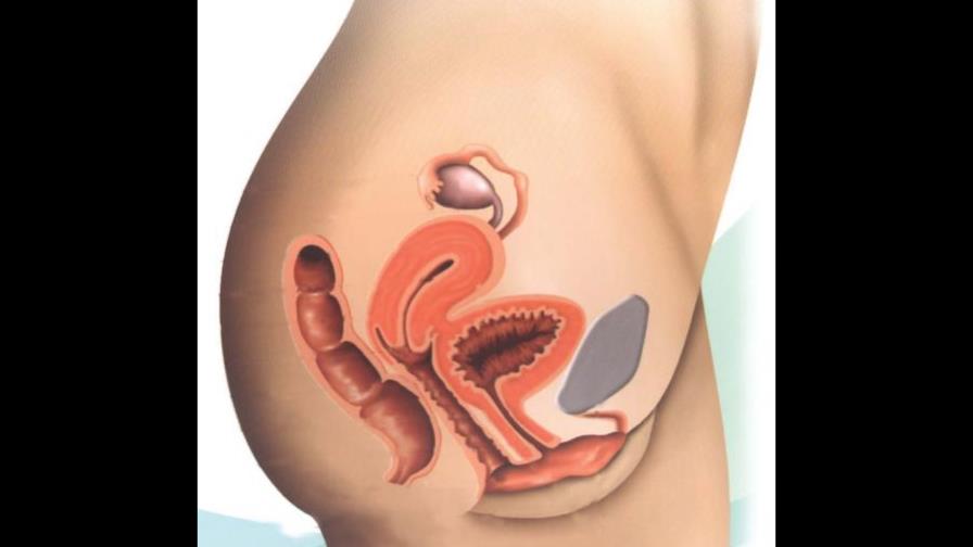 El papanicolau, salvador de órganos femeninos