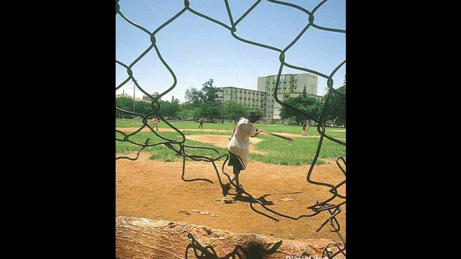 En RD, 58% de casos de esteroides de GL En RD, 58% de casos de esteroides de GL