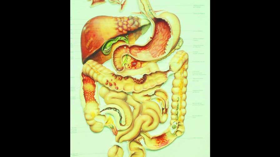 Enfermedades del estómago, muy frecuente en estos días