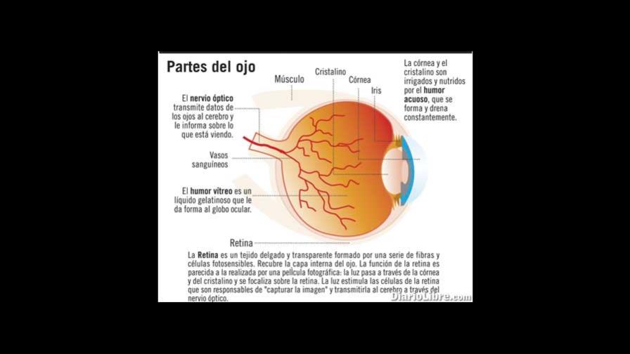 Conozca sobre el desprendimiento de retina Conozca sobre el desprendimiento de retina
