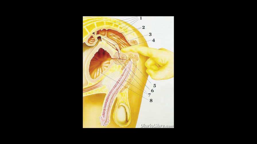 Las nuevas semillas permiten radiación más intensa en cáncer