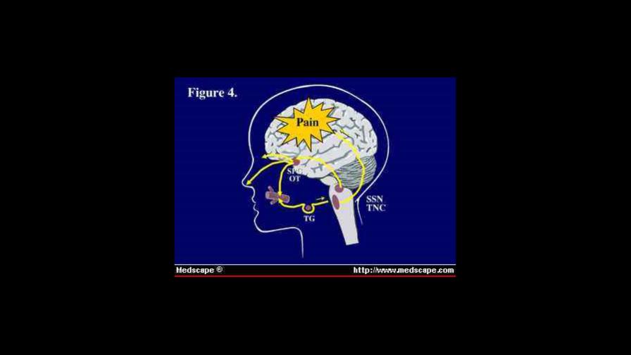 El sexo produce cefaleas, a veces explosivas