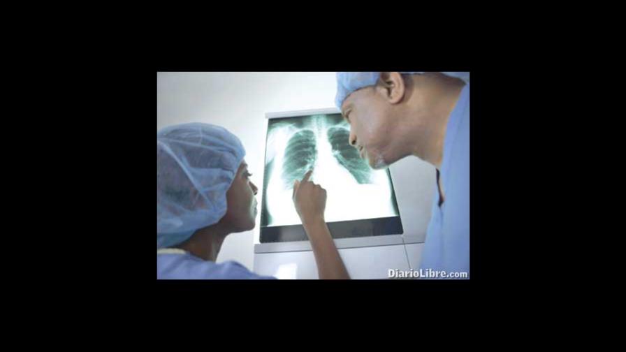 Fibrosis quística, una infección pulmonar que afecta a órganos Fibrosis quística, una infección pulmonar que afecta a órganos