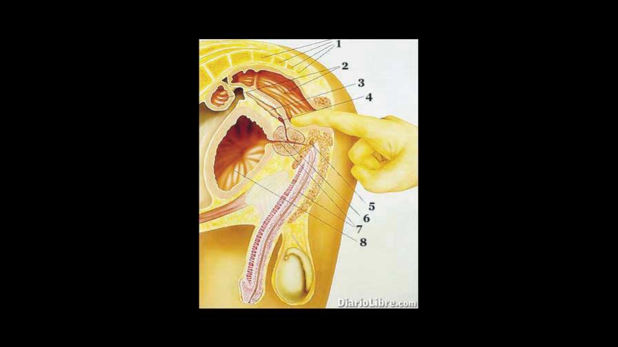Identifican molécula muy ligada al cáncer de próstata Identifican molécula muy ligada al cáncer de próstata