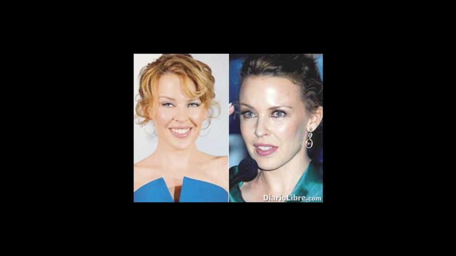 Kylie rejuvenece con 80 mil dólares