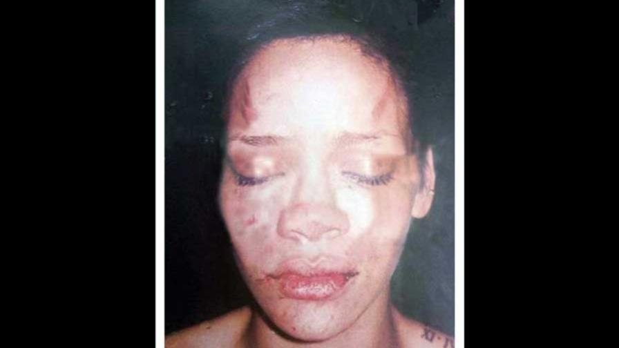 Campaña recrea la agresión a Rihanna