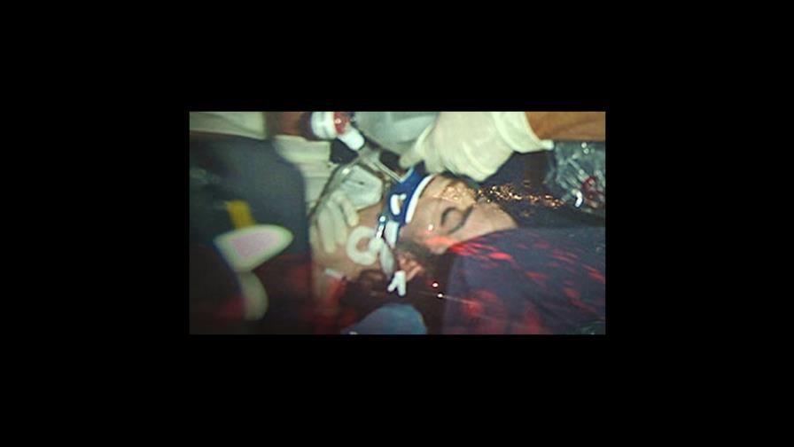 Cadáver de Michael Jackson era casi un esqueleto