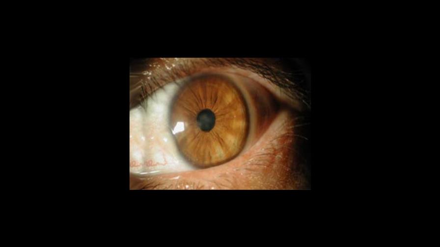 Retinopatía diabética: una enfermedad silente Retinopatía diabética: una enfermedad silente
