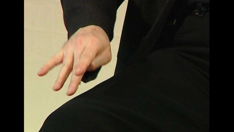 Transtornos del sueño y pérdida de olfato son síntomas de Parkinson