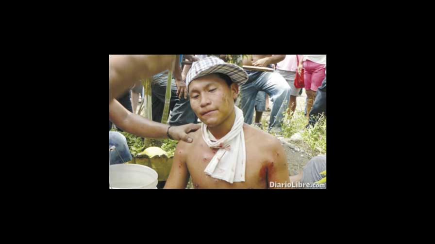 Br. - De todo el mundo