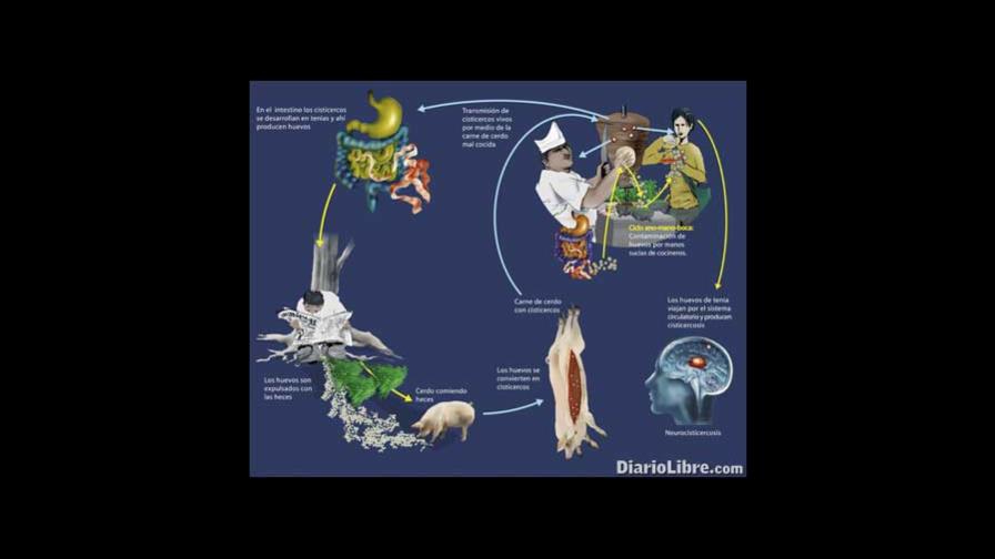 Cisticercosis, un enemigo silente