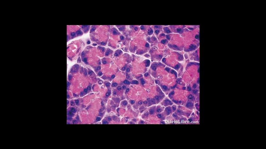 Los suplementos de enzimas digestivas