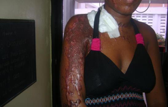 Aseguran El Plomerito incrementa criminalidad