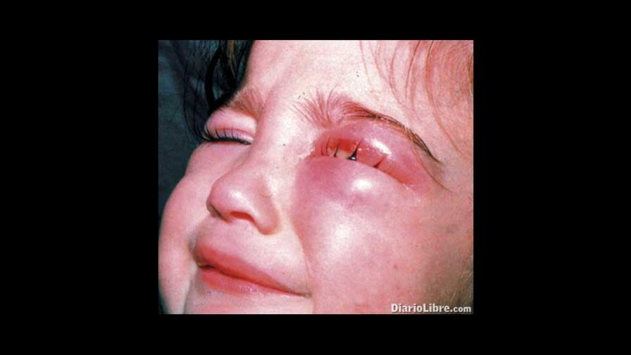 HCP. - Hablando con el pediatra.