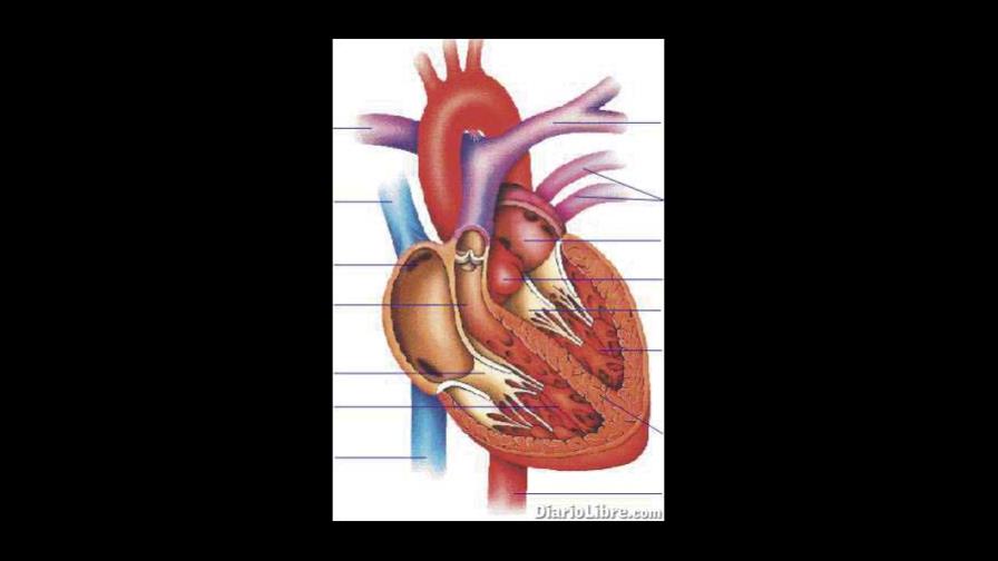 Cirugía robótica de corazón, por Internet