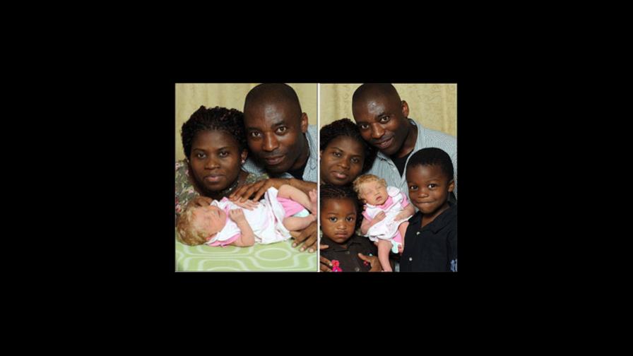 Padres negros nigerianos tuvieron bebé rubia en Londres