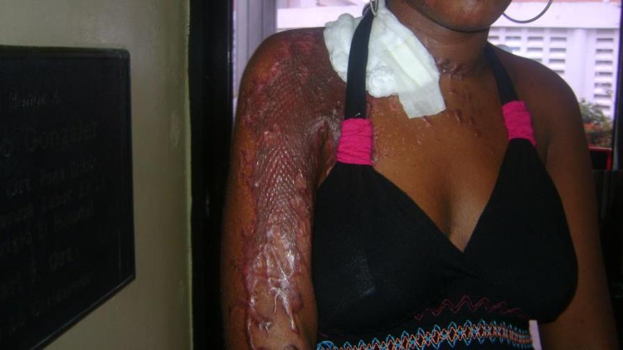 Prohíben venta del ácido del diablo