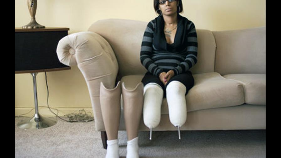 Fue al ginecólogo y se quedó sin piernas