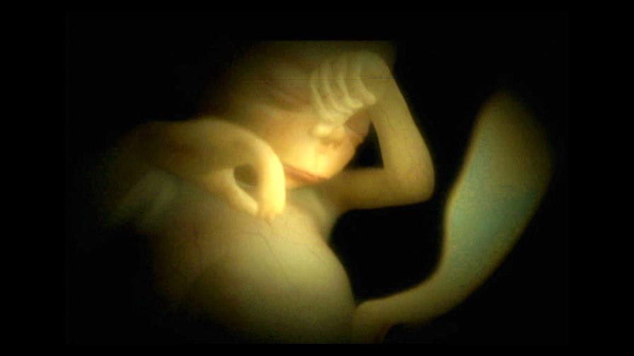 Feto humano no siente dolor antes de las 24 semanas